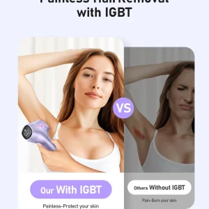 IPL Hair Removal Device - Thumbnail Image 6