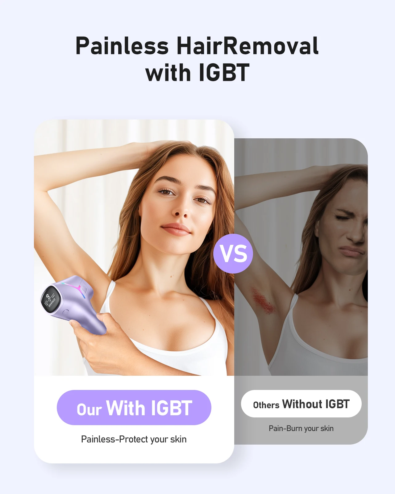 IPL Hair Removal Device - Image 6